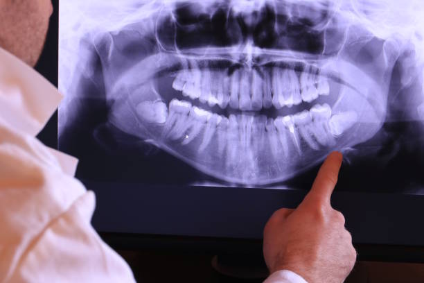 Best Tooth Pain Emergency Relief  in New Baltimore, OH