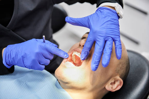 Best Dentist for Tooth Abscess  in New Baltimore, OH