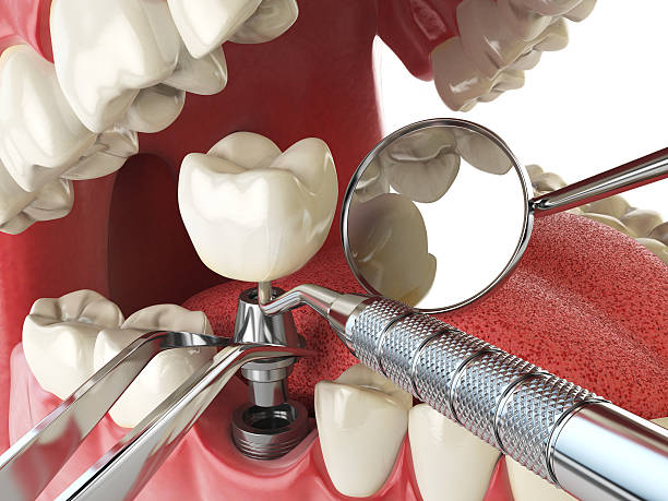 Best Tooth Pain Emergency Relief  in New Baltimore, OH